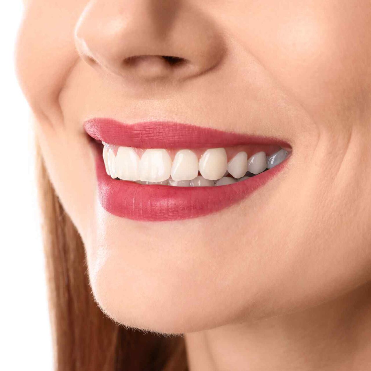 https://smileviadentaltourism-ks.com/wp-content/uploads/2020/03/service_whitening-1280x1280.jpg